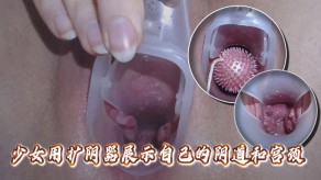 变态拍摄少女用扩阴器展示自己的阴道和宫颈扩阴道视频